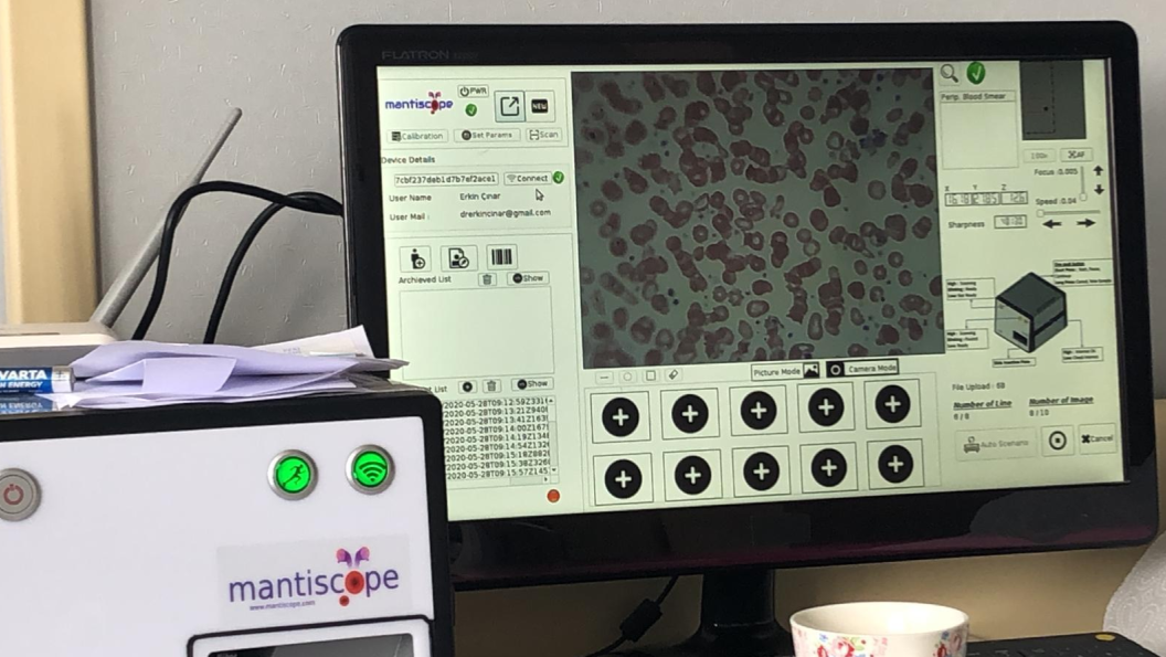 Mantiscope Scanner 